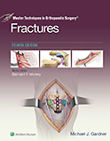 Image of the book cover for 'Master Techniques in Orthopaedic Surgery: Fractures'