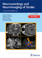 Image of the book cover for 'Neurosonology and Neuroimaging of Stroke'