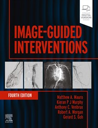 Image-Guided Interventions
