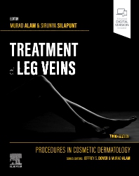 Image of the book cover for 'Treatment of Leg Veins'