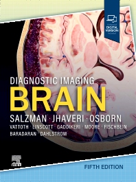 Image of the book cover for 'Diagnostic Imaging: Brain'